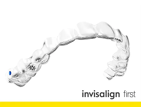 インビザラインファーストとは