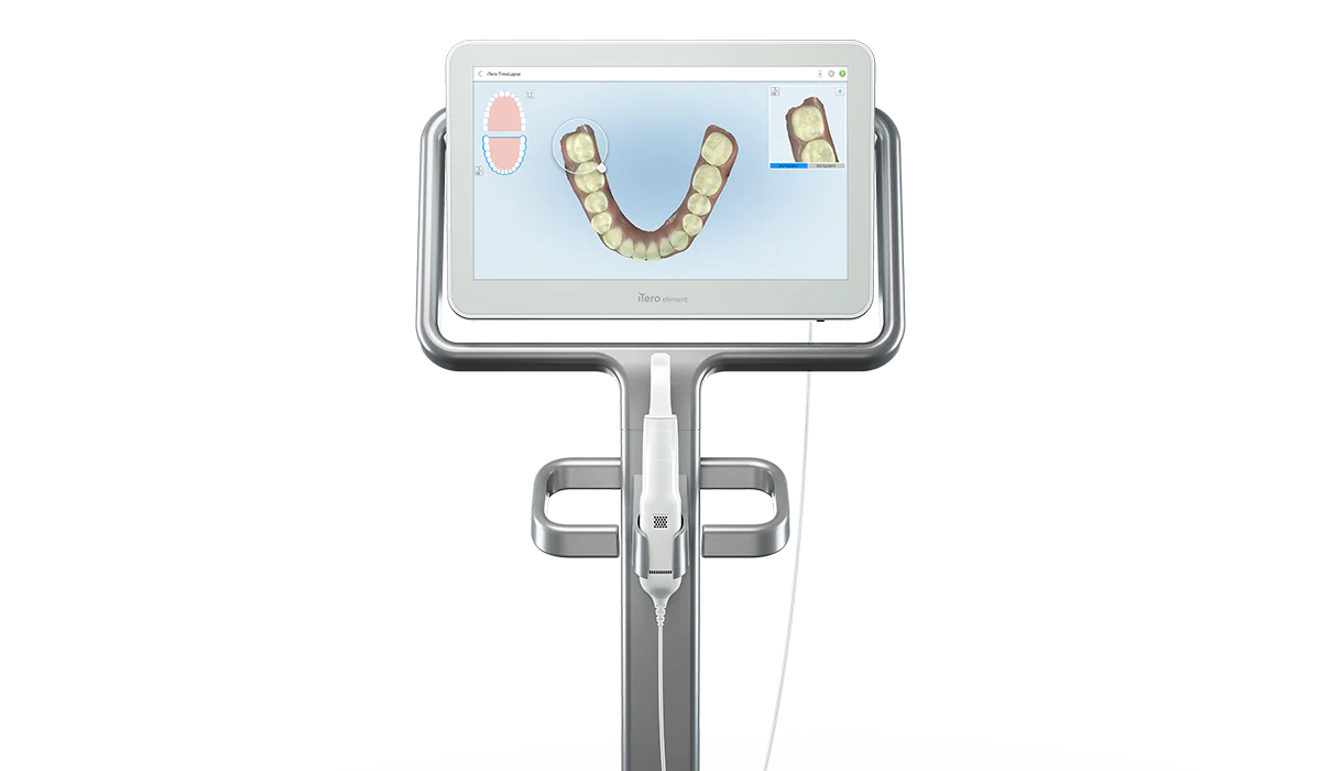 「iTero（アイテロ）」導入で負担の少ない歯型取りが可能