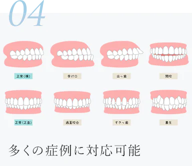 多くの症例に対応可能