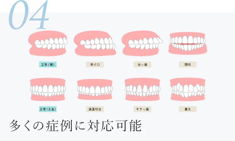 多くの症例に対応可能